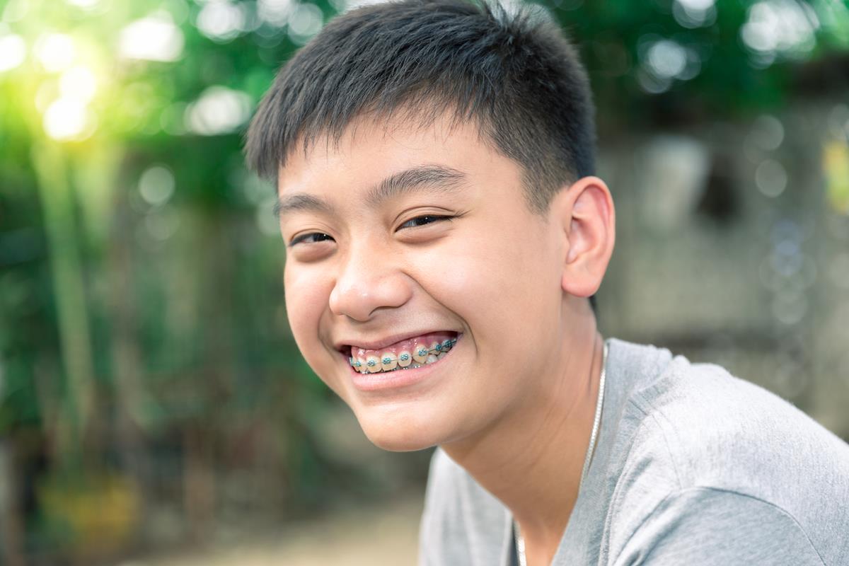 Braces for Teens